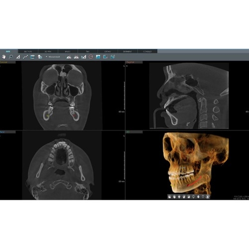 Tomografo Pax i 3D Green X 16 Vatech