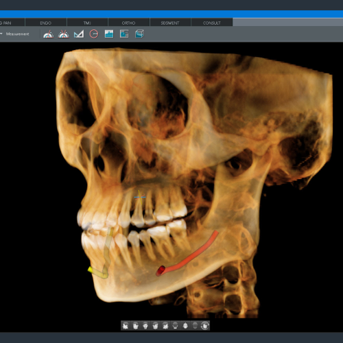 Tomografo Pax i 3D Green X 16 Vatech