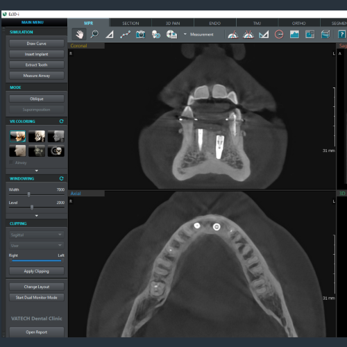 Tomografo Pax i 3D Green X 16 Vatech