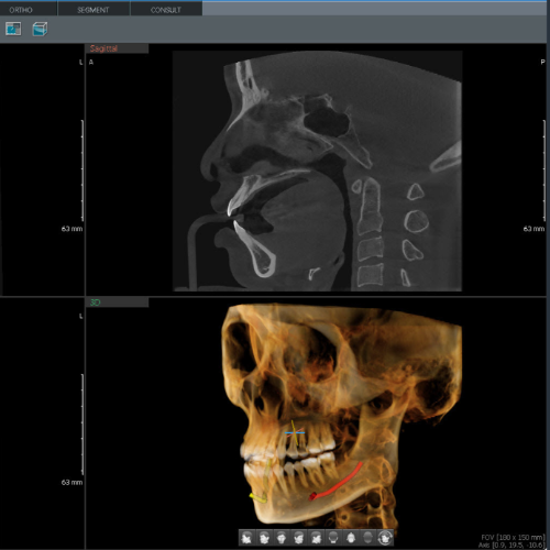 Tomografo Pax i 3D Green X 16 Vatech