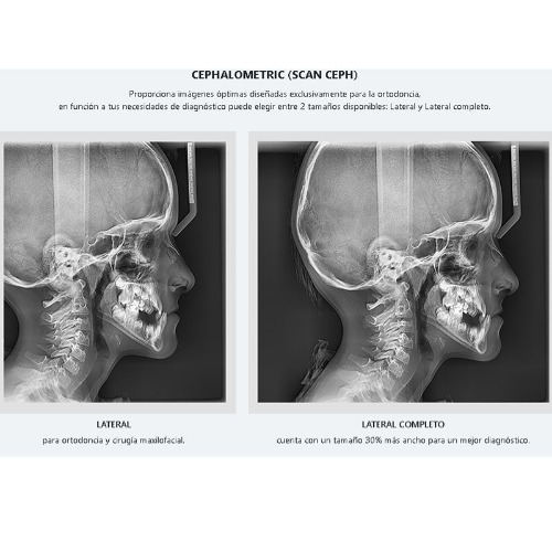 Ortopantomografo Pax i 2D PanoCeph