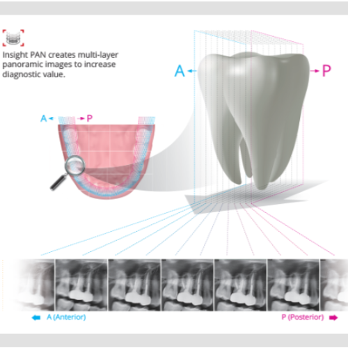 Smart Plus 3D