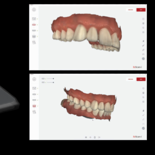 Escáner intraoral EzScan Vatech