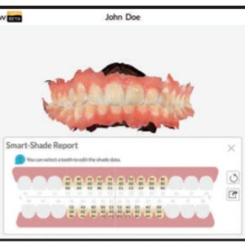 Escaner Intraoral Dexis 3600