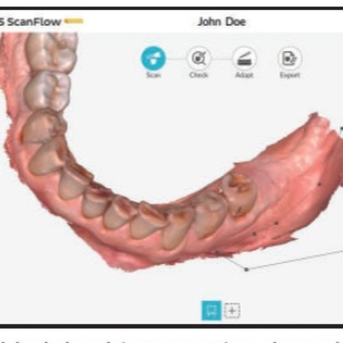 Escaner Intraoral Dexis 3600